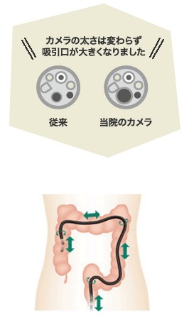 検査時間の短縮
