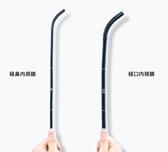 経口内視鏡との違い