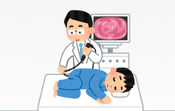 大腸内視鏡