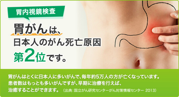胃内視鏡検査 