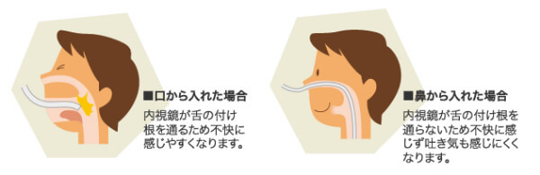 当院の胃内視鏡検査の特徴