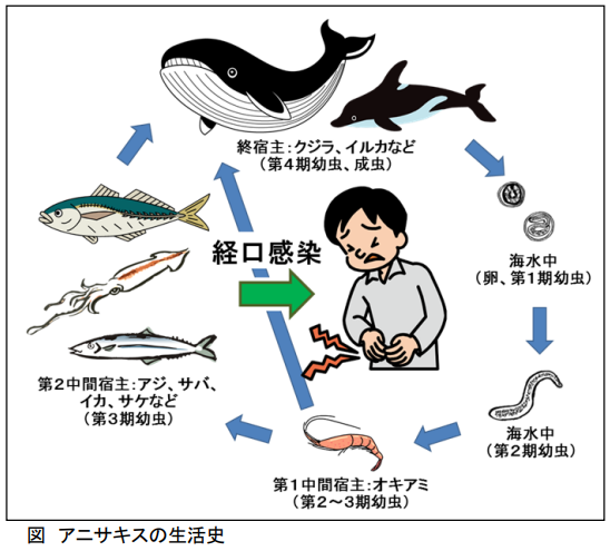 胃カメラ
