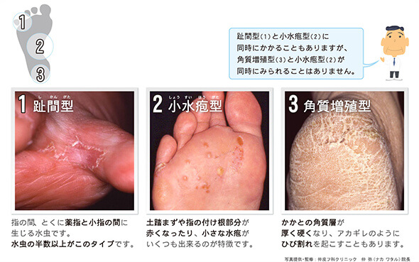 江東区で皮膚科をお探しなら日曜診療の菊川内科皮膚科クリニック