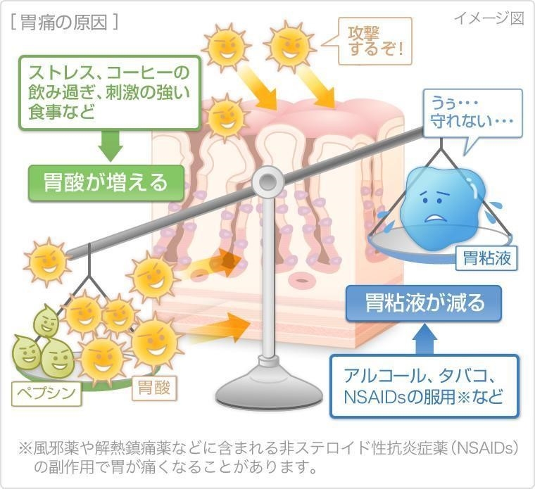 胃痛