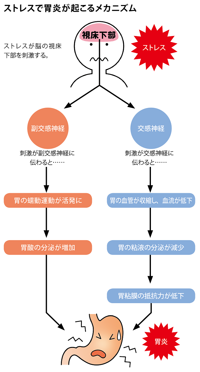 胃痛